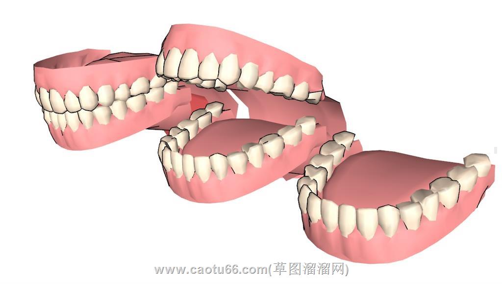 牙齿假牙SU模型
